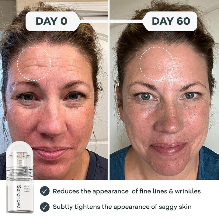 Micro Infusion System for Face & Neck 0.05Mm Stamp with Hyaluronic Acid & Collagen Peptide Serum for Firmer Smoother-Looking Skin, Easy 5-Minute At-Home Skin Care Application - 3 Month Supply