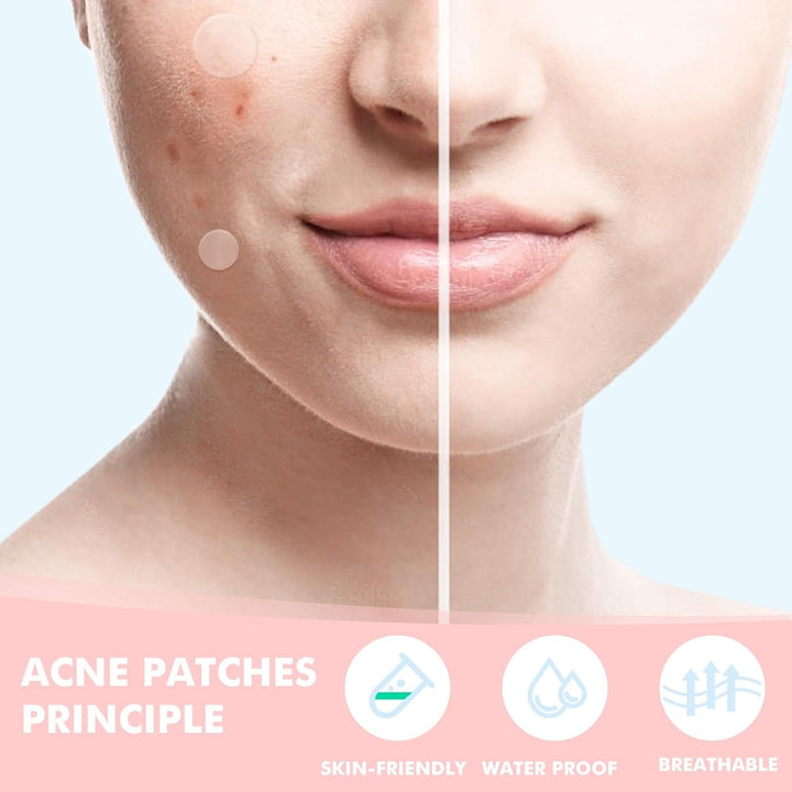 Pimple Patches for Face 316Pcs,Hydrocolloid Acne Patches Star,Zit Patches,Pimple Popper Tool Kit,Facial Skin Care Products Containing Salicylic Acid,Tea Tree Oil and Calendula Oil