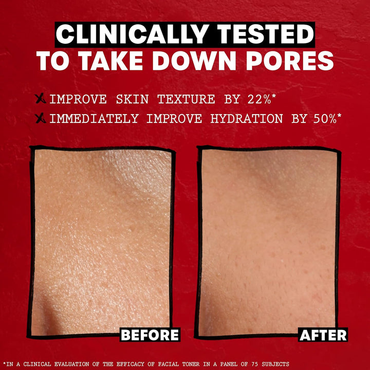 Alcohol-Free Rose Petal Witch Hazel Facial Toner for Glowing Skin, Soothing, Hydrating, Refreshing Toner for All Skin Types, 12Oz (Packaging May Vary)