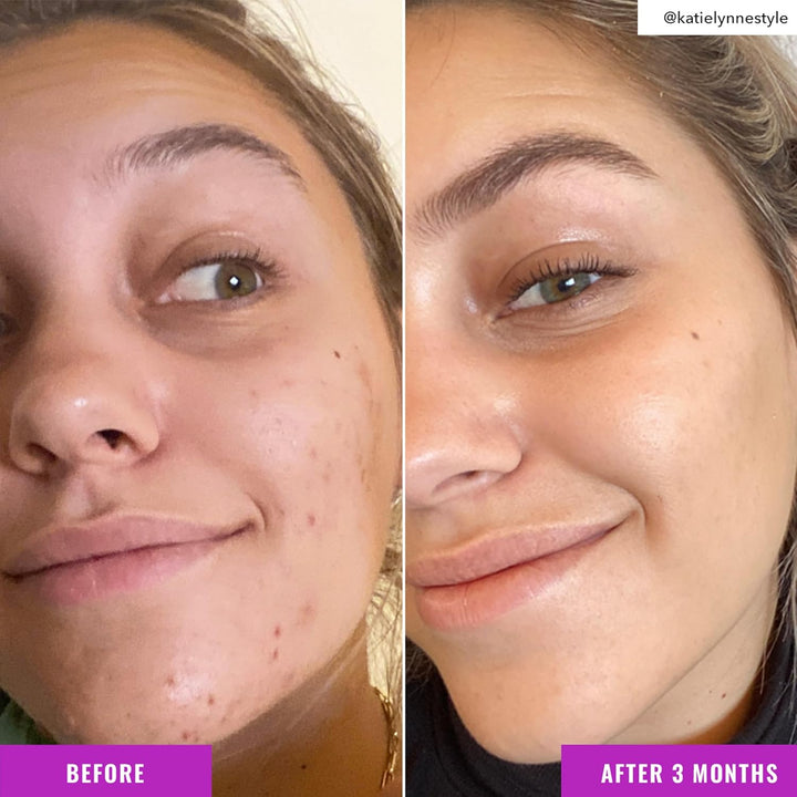 Niacinamide Brightening Toner - Toner for Face with Niacinamide and Arbutin for Skin Tone Balancing- Pore Minimizer, Facial Skin Care