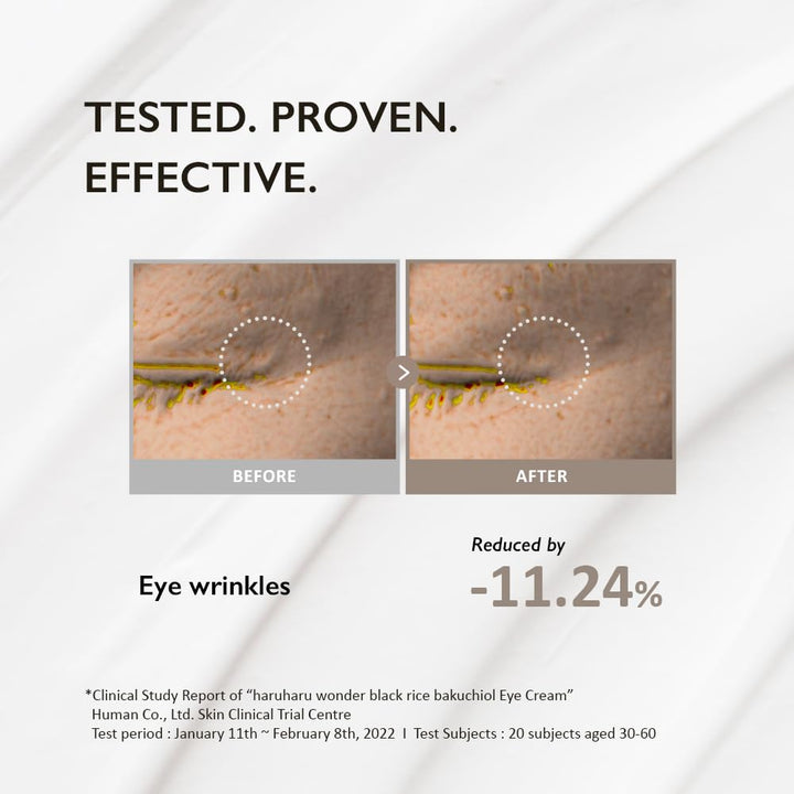 Wonder Black Rice Bakuchiol Eye Cream 0.67 Fl.Oz / 20Ml | Anti-Aging, Wrinkle Care, Natural Retinol Alternative | Cruelty Free, Ewg-Green