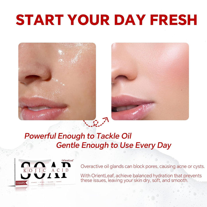 Kojic Acid Soap, Turmeric Soap Bar for Dark Spots, Fresh Citurs Scent, Gentle for Face and Body Wash with Vitamin C, Shea Butter, Retinol, Olive Oil, Collagen (3 PACK)