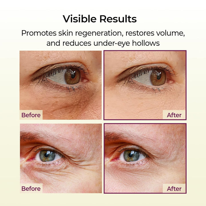 Cemenrete Calcium Multi Balm 9G Korean Skin Care All in One Stick Collagen Face Eye Treatment Balm