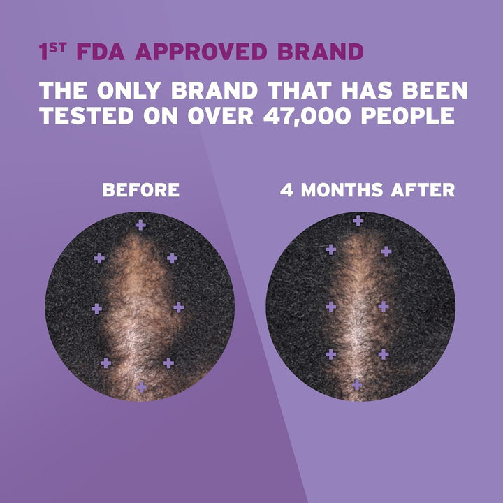 for Women 5% Minoxidil Foam, Growth Treatment for Thinning & Hair Loss, Once-A-Day Unscented Topical Foam, Regrow Fuller Thicker Hair, Dermatologist Recommended, 4-Month Supply, 2 X 2.11 Oz