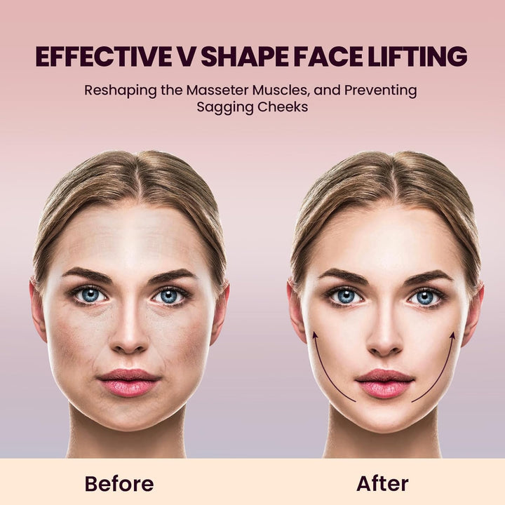 Electric Double Chin Device and V-Face Machine with 8 Modes and 15 Gear Adjustable Intensities - Intelligent Double Chin Machine for V-Face - White