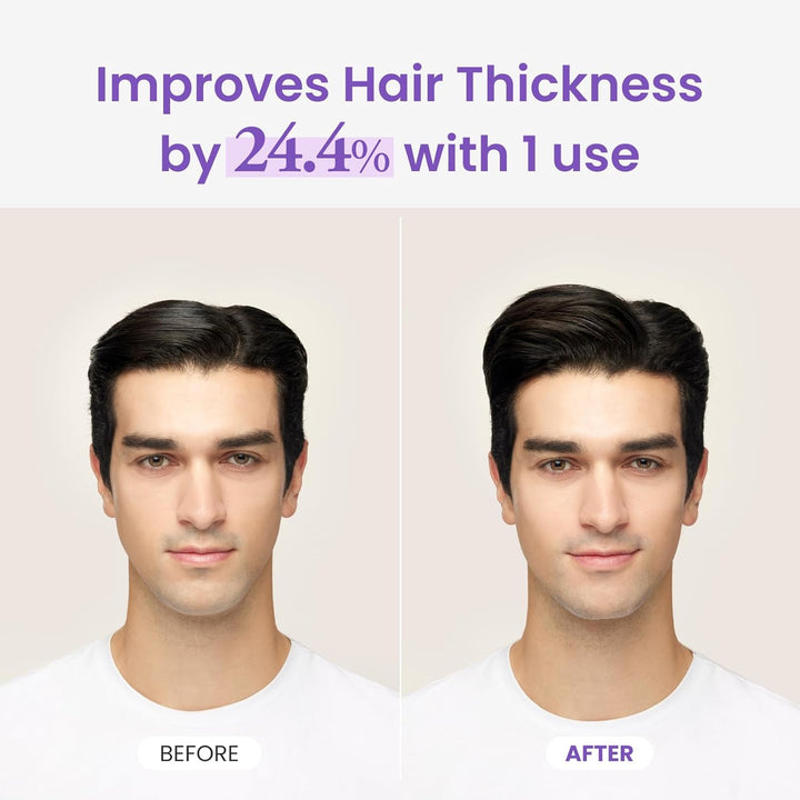 Dr.Groot Rosemary Mint Oil Tonic for Hair Growth with Biotin, Hyaluronic Acid, Thickening & Scalp Nourishing. Korean Haircare. Sulfate-Free, Silicon-Free, Paraben-Free (3.38 Fl Oz/ 100Ml)