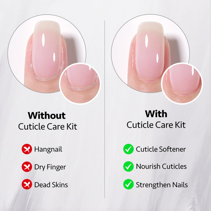 Cuticle Care Kit - Cuticle Oil and Cuticle Remover, 20Ml 2 Pcs Cuticle Nourishes and Softener, Promotes Nail Growth and Strength