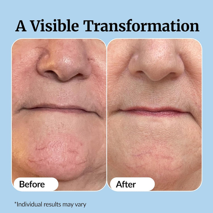 Super C Serum for Mature Skin - All-In-One Vitamin Formula Hydrates, Firms, Lifts, Smooths, Targets Age Spots, Wrinkles, 1 Fl Oz