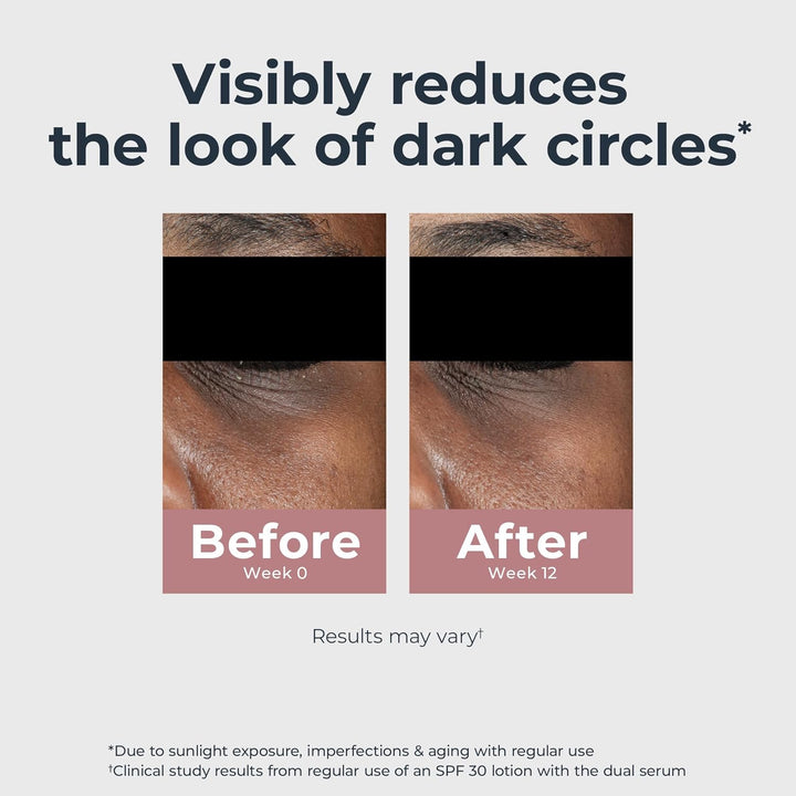 Radiant Tone Eye Cream Dark Circle Corrector, Eye Brightening Cream with Thiamidol and Hyaluronic Acid, Helps Reduce the Look of Eye Puffiness, 0.5 Oz Tube