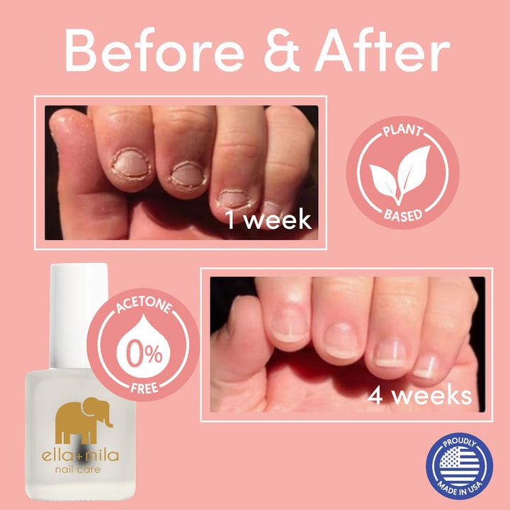 No More Biting Nail Polish - Bitter Taste Nail Biting Treatment for Kids & Adults - Stop Thumb Sucking Deterrent - Finger Biter Prevention (0.45 Fl Oz)