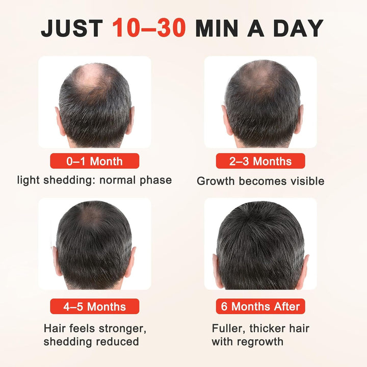 Laser Hair Growth Cap