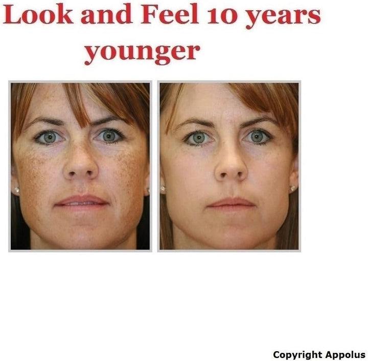 Microdermabrasion Machine -  Premium Diamond Microdermabrasion Device Tool - 2 Diamond Tips - 5 Heads - Blackhead Blemishes Remover - Pores Fine Lines Minimizer