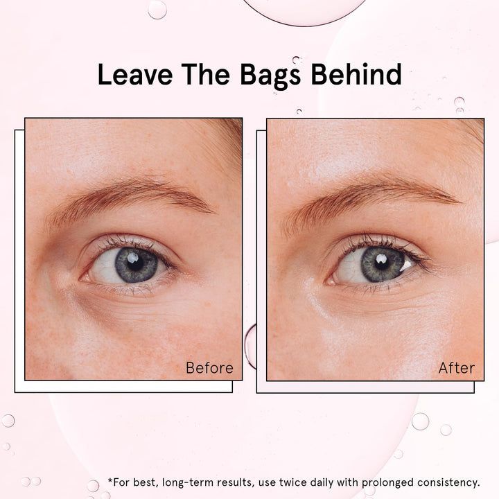 under Eye Brightener Roller - Airplane Travel Essentials - Travel Size Toiletries - Retinol & Caffeine Eye Serum for Puffiness, Dark Circles, Wrinkles - Vegan Skincare (15Ml / 0.51Floz)