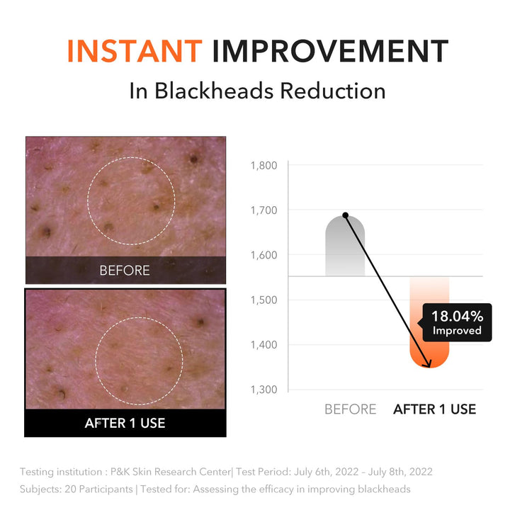 Carrotene IPMP Hydromelt Cleansing Balm, 3.04 Fl.Oz, Noncomedogenic, Grapefruit Peel Oil, O-Cymen-5-Ol Helps Reduce Blackheads & Breakouts, for Sensitive & Oily Skin, Korean Skincare