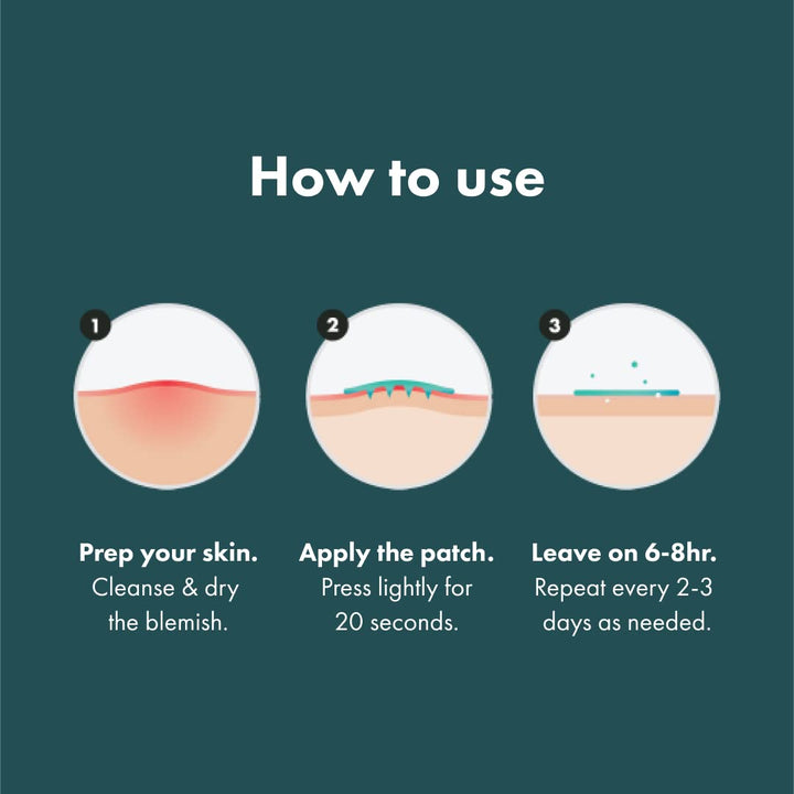 Micropoint Large Hydrocolloid Pimple Patches for Face Blemishes from , Acne Stickers for Early Stage Zits & Hidden Pimples, 395 Proprietary Micropoints, 8 Count