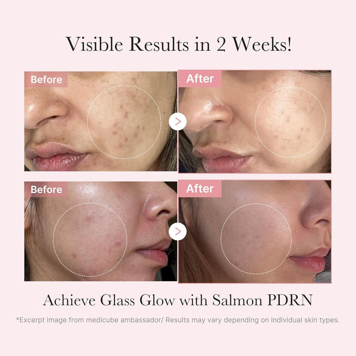 Salmon DNA PDRN Trial Kit | Glass Glow Mini Skincare Set with Toner, Serum & Sheet Mask for Hydrating, Firming, Moisturizing |Gift & Travel Essentials for Women & Girls | Korean Skincare