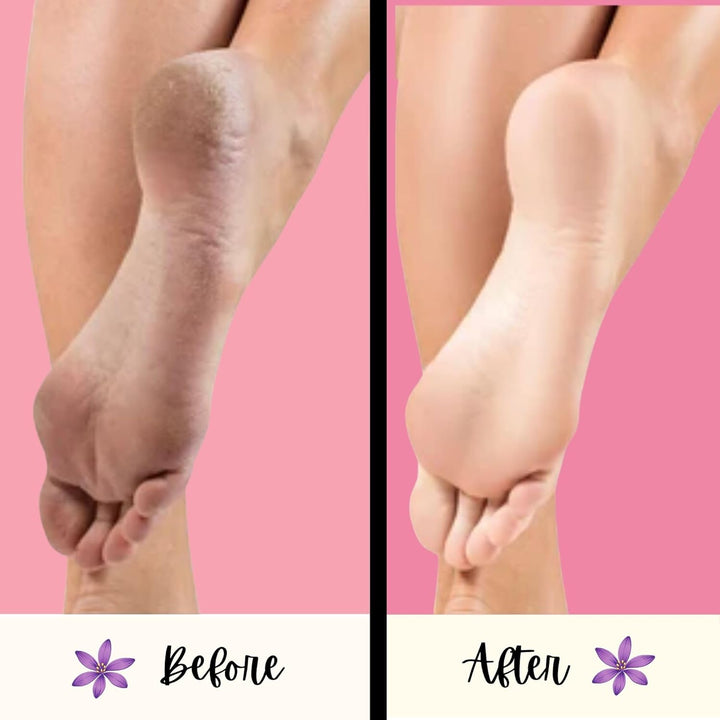 Purple PUMI Bar - Extra-Coarse, Pumice Stone for Feet Callus Remover, Pedicure Tools for Feet, Foot Scrubber for Dead Skin Remover, Foot Care, 4 Pack