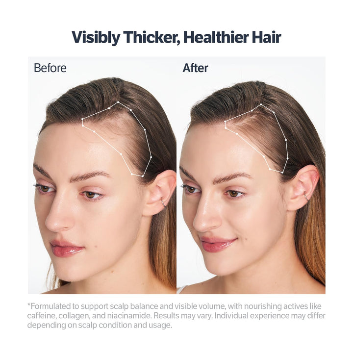 Deep Collagen Retinol Power Boosting Scalp Serum | Roll on Hair Growth, Hair Thickening Serum, Itchy & Dry Scalp Treatment, Caffeine, Biotin, Rosemary – Korean Hair Care, 0.5 Fl Oz