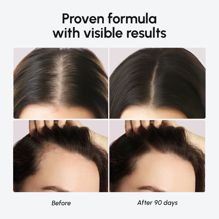 Hair Growth Serum - Caffeine Peptides Castor Rosemary Oil for Hair Growth - Products for Women & Men - Hair Oils for Hair Growth - Hair Regrowth Tonic - Scalp Serum - Suero Para El Cabello