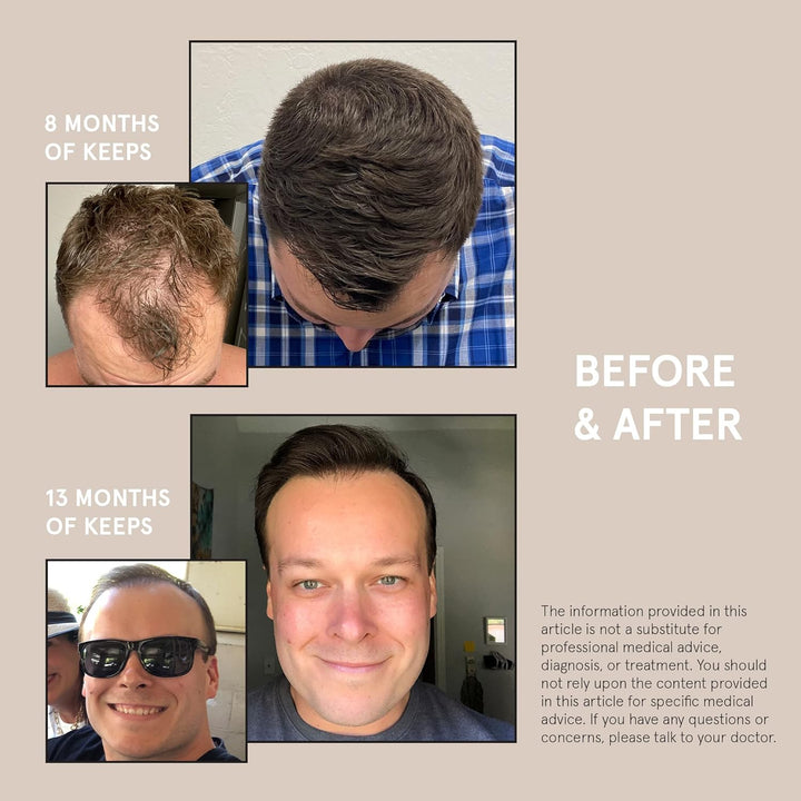 Hair Loss Shampoo for Men - Mens Shampoo for Fuller, Thicker Looking Hair - Thinning & Hair Growth Product - DHT Blocker - Infused with Biotin, Caffeine & Saw Palmetto - 8 Oz