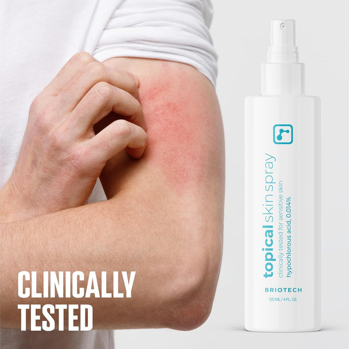 Topical Skin Spray, Hypochlorous Acid Spray for Sensitive Skin, Hocl Facial Mist, Full Body Support against Irritation, Calm Redness, Soothe Foot & Scalp, 8 Oz (1 Pack)