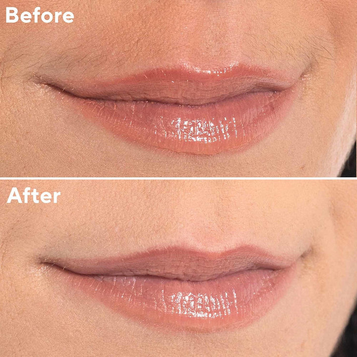 Facial Hair Remover for Women, Rose Gold Electric Face Razor with LED Light, Recyclable Packaging