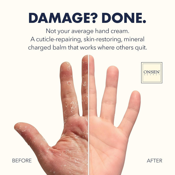 Hand & Cuticle Rescue Cream | Organic Nail Strengthener & Balm | Dry, Cracked Hands, Elbows & Feet | Shea Butter, Tsubaki & Jojoba Oil | Nail Repair & Growth, Vegan - 1 Pack (0.88 Oz)