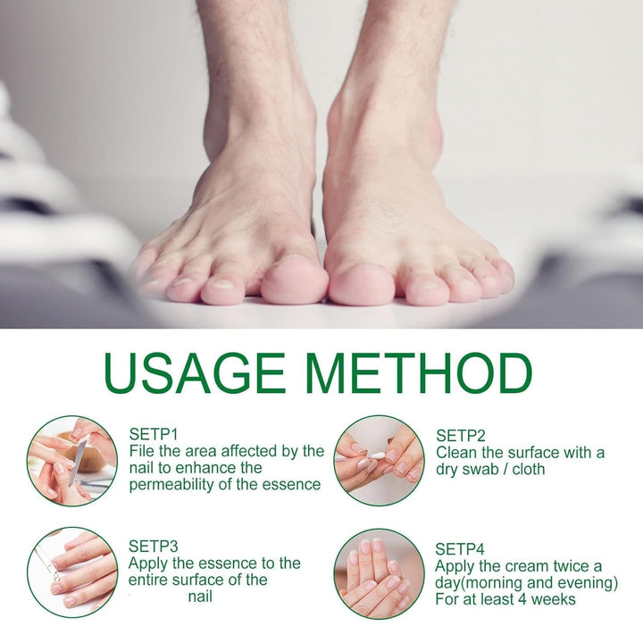 Ginger Nail Treatment, Ginger Cuticle Care Oil for Nails (2 PCS)