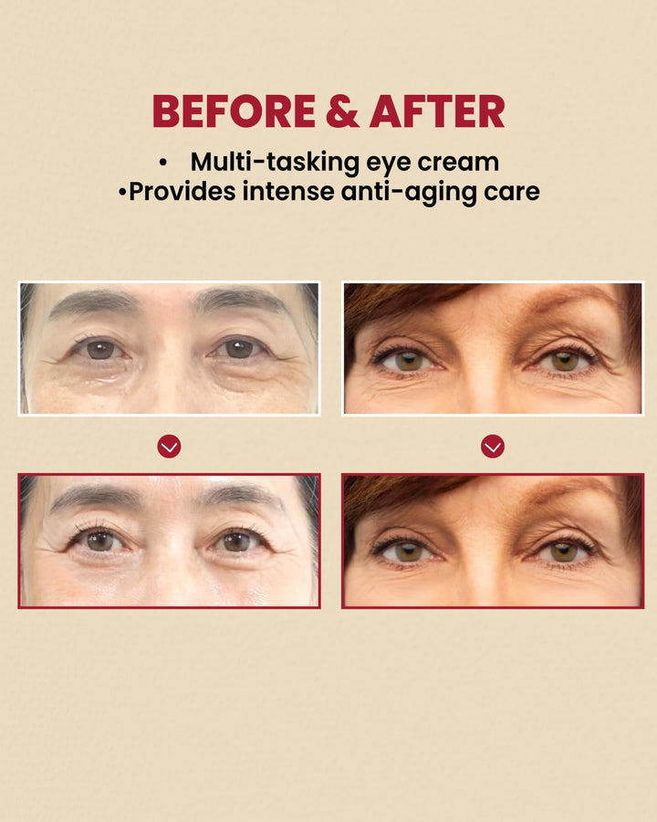 KSECRET SEOUL 1988 Eye Cream : Retinal Liposome 4% + Fermented Bean, Wrinkle Care, Anti-Aging, Skin Elasticity, Pigmentation, Retinol, 30Ml/1.01 Fl.Oz.