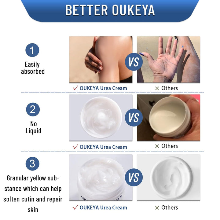Urea Cream 40 Percent,Foot & Hand Cream for Dry Cracked,Urea Lotion for Feet Maximum Strength