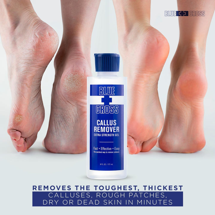 Callus Remover Gel for Feet or Heel, Extra Strength Professional Nail Care, File, Shaver, Scrubber & Pumice Stone Alternative for at Home Manicure/Pedicure Results, 6Oz