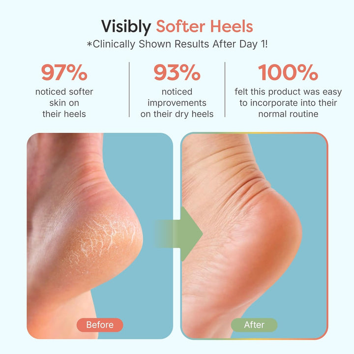 Moisturizing Socks for Cracked Heel Treatment - Vitamin E, Olive Oil and Jojoba Oil Infused Heel Socks to Soften and Hydrate (Fuzzy Blue, Regular)