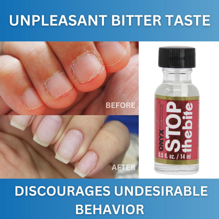 Stop the Bite Nail Biting Prevention Polish, 0.5 Fl Oz - Made in USA, Stop Nail Biting, No Bite Nail Polish, Thumb Sucking Deterrent