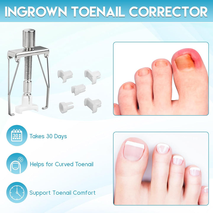 Ingrown Toenail Removal Kit, Professional Ingrown Toenail Tool Kit Includes Ingrown Toenail Corrector Drops, Corrector Patch, Toenail Clipper, Nail File Lifter Pedicure Tools