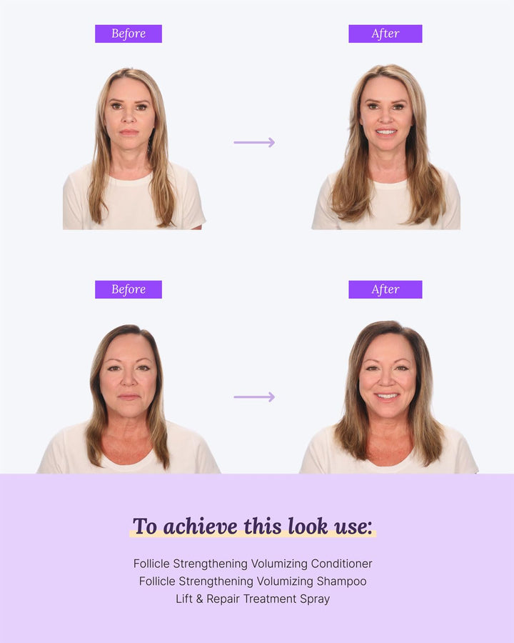 Hair Regrowth Treatment Dropper – 2% Minoxidil, 2 Fl Oz 30 Day Supply – Regrow Thicker-Looking Hair, Helps Revitalize Hair Follicles