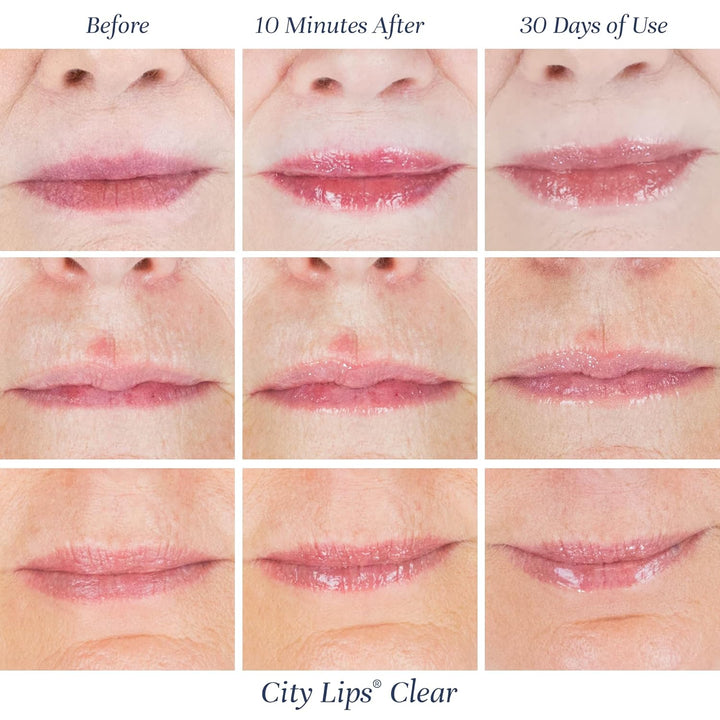 City Lips Clear - Plumping Lip Gloss - Hydrate & Volumize - High Shine Lip Plumper - Hyaluronic Acid & Peptides Visibly Smooth Lip Wrinkles - Cruelty-Free