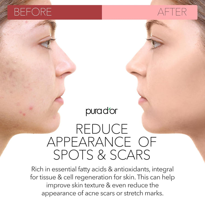 4 Oz ORGANIC Rosehip Seed Oil - 100% Pure Cold Pressed USDA Certified Anti-Aging Treatment - Vitamin a & C Rich - Helps Fade Appearance of Scars & Stretch Marks - for Face, Hair & Body