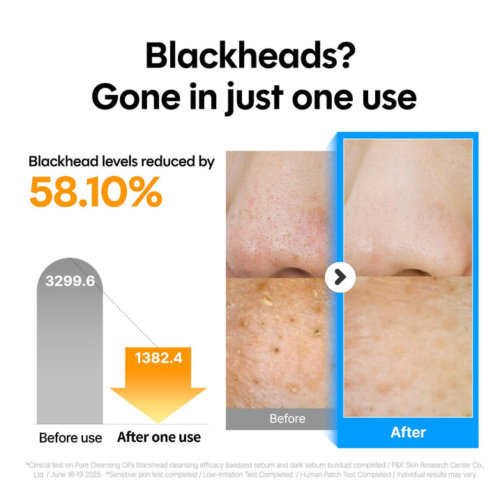 Pure Cleansing Oil, Natural Oil Cleanser for Face, Makeup Blackhead Remover, Korean Skin Care, 6.76 Fl Oz (200Ml)