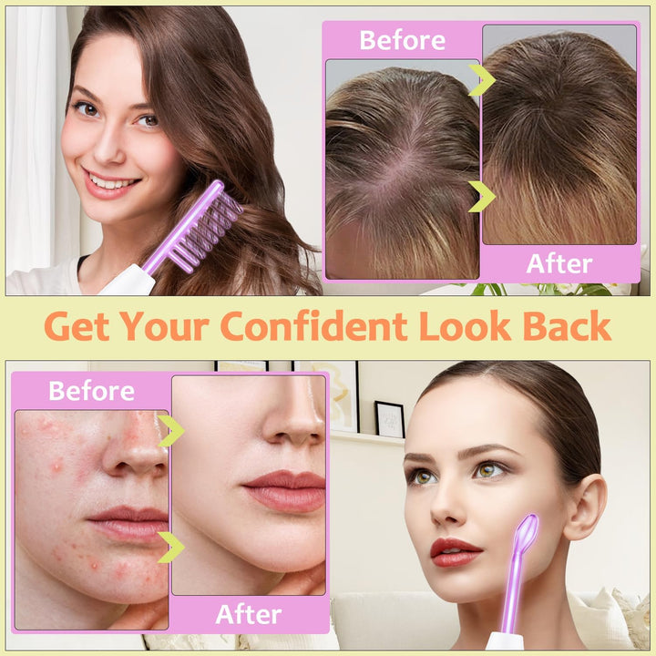 High Frequency Facial Wand -  4 in 1 Violet Portable Handheld High Frequency Facial Machine - at Home Face Skin Wand Device with 4 Pcs Purple Glass Tubes