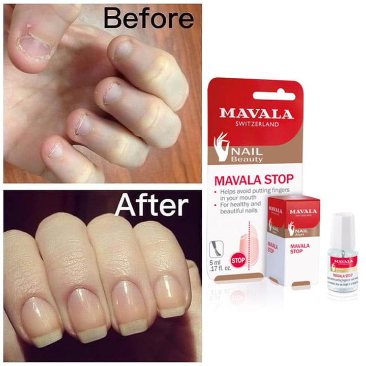 Stop Deterrent Nail Polish Treatment | Nail Care to Help Stop Putting Fingers in Your Mouth | Bitter Taste| Easy Application | for Ages 3+ | 0.17 Oz