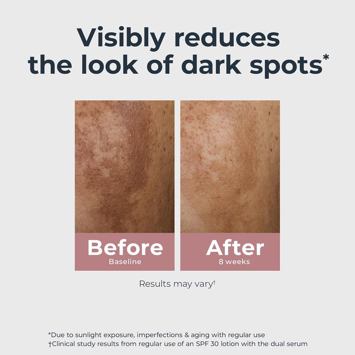 Radiant Tone Dual Serum Dark Spot Corrector, Dark Spot Serum with Thiamidol and Hyaluronic Acid, Helps Visibly Reduce the Look of Persistent Dark Spots, 1 Fl Oz Bottle