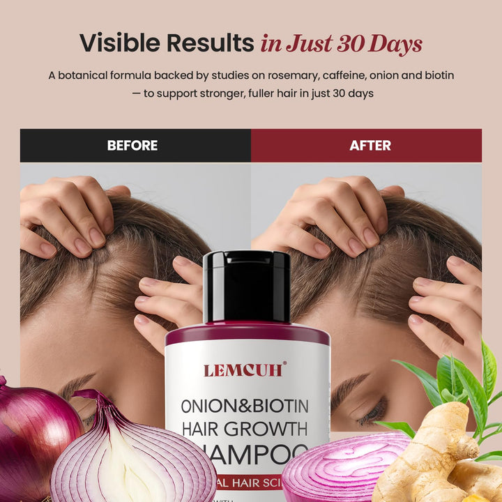 Onion & Biotin Hair Growth Shampoo: Infused with Natural Rosemary Tea Tree anti Hair Loss Shampoo - Scalp Smooths Thickening Formula Support Hair Regrowth for Women Men 12.5Fl Oz