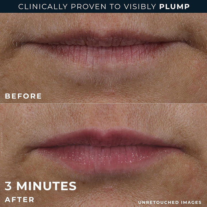 Derm Correxion Lip Volumizer - Lip Plumper Peptide Treatment with Hyaluronic Acid & Vitamin E + Line Smoothing Eye Cream Packette