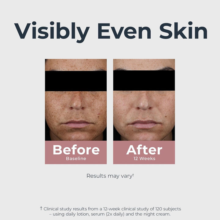 Radiant Tone Dual Serum Dark Spot Corrector, Dark Spot Serum with Thiamidol and Hyaluronic Acid, Helps Visibly Reduce the Look of Persistent Dark Spots, 1 Fl Oz Bottle