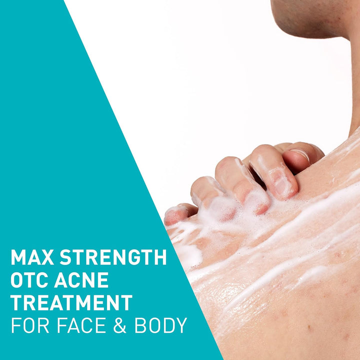 Acne Foaming Cream Wash, Gentle Face and Body Cleanser with Benzoyl Peroxide 10%, Hyaluronic Acid, and Niacinamide, 10% Benzoyl Peroxide Treatment Clears Pimples and Blackheads 5 Oz