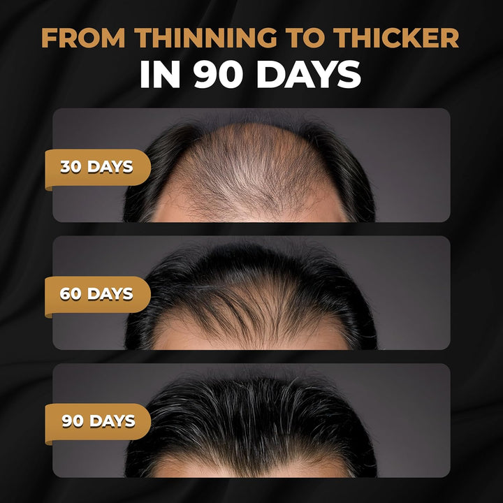 ™ Root Activator Conditioner for Men - Hair Growth Conditioner, Thickening Hair Moisturizer for Hair Loss and Thinning Hair