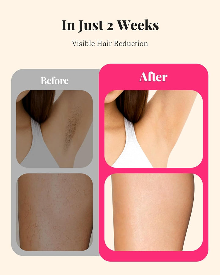 Laser Hair Removal for Women and Men, At-Home IPL Hair Removal Device with 5.2 Cm² Treatment Window, Nearly Painless, Visible Results in 2 Weeks, Full Body Treatment in 8 Minutes