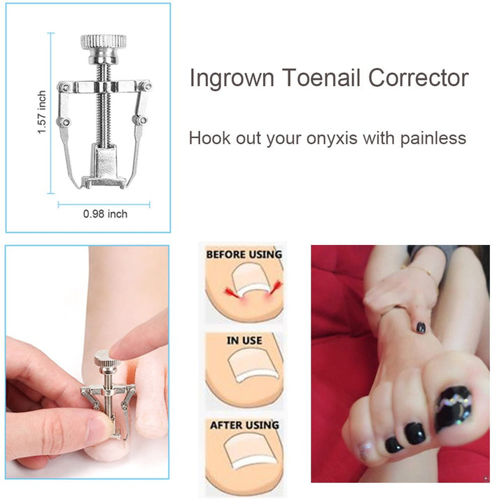 10Pcs/Set Ingrown Toenail Tools Kit, Nail Treatment Foot Tool,Ingrown Toenail Removal Correction Clippers, Surgery Grade Nail File Lifter, Professional Pedicure Tool