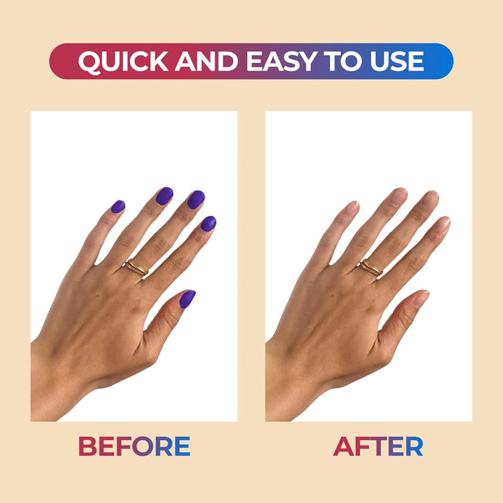 100% Pure Acetone Nail Polish Remover | Professional Quality | Easy to Use | Rapidly Removes Natural, Gel, Acrylic, and Glitter Nails | 8 Fl Oz
